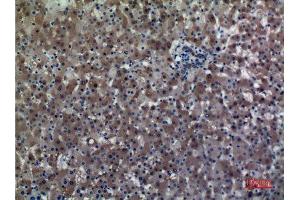 Immunohistochemistry (IHC) analysis of paraffin-embedded Human Liver, antibody was diluted at 1:100. (ALDH1A1 抗体  (N-Term))