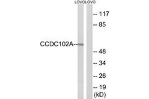 Western blot analysis of extracts from LOVO cells, using CCDC102A Antibody. (CCDC102A 抗体  (AA 341-390))