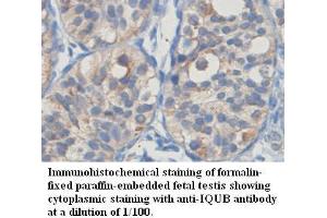 Image no. 1 for anti-IQ Motif and Ubiquitin Domain Containing (IQUB) antibody (ABIN1577302) (IQUB 抗体)