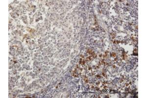 Immunoperoxidase of purified MaxPab antibody to TXNDC5 on formalin-fixed paraffin-embedded human lymph node. (TXNDC5 抗体  (AA 1-360))