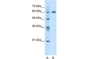 WB Suggested Anti-PDLIM5 Antibody Titration:  2. (PDLIM5 抗体  (C-Term))
