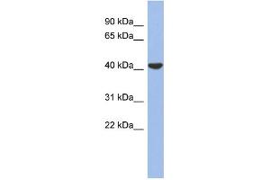 WB Suggested Anti-GJD4 Antibody Titration:  0.