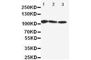 Western Blotting (WB) image for anti-ATPase, Ca++ Transporting, Cardiac Muscle, Fast Twitch 1 (ATP2A1) (AA 665-680), (Middle Region) antibody (ABIN3044279)