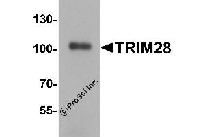 Western Blotting (WB) image for anti-Tripartite Motif Containing 28 (TRIM28) (C-Term) antibody (ABIN1077358) (KAP1 抗体  (C-Term))
