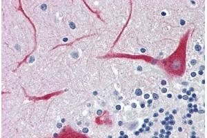 Immunohistochemistry (Formalin-fixed Paraffin-embedded Sections) (IHC (fp)) image for anti-ATPase, Ca++ Transporting, Ubiquitous (ATP2A3) (AA 501-621) antibody (ABIN790453)