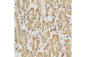 Immunohistochemistry of paraffin-embedded human stomach using PRDX4 antibody at dilution of 1:200 (x400 lens) (Peroxiredoxin 4 抗体  (AA 38-271))