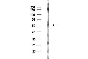Western blot analysis of lysates from COLO205 cells(UV,30 min treatment), using CCM2 Antibody at 1/1000 dilution.