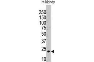 The ISG15 polyclonal antibody  is used in Western blot to detect ISG15 in mouse kidney tissue lysate. (ISG15 抗体  (N-Term))