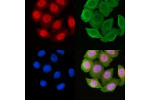 ABIN6256976 and ABIN6274481 staining Hela cells(45 min of heat-shock) by IF/ICC. (Cyclin-Dependent Kinase 15 (ALS2CR7) (Internal Region) 抗体)