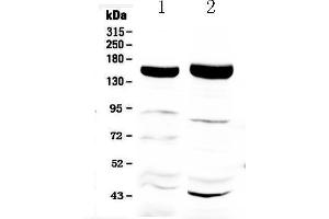 Western blot analysis of Xanthine Oxidase using anti-Xanthine Oxidase antibody . (XDH 抗体  (AA 2-343))