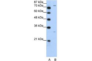 WB Suggested Anti-PTGS1 Antibody Titration:  5. (PTGS1 抗体  (N-Term))