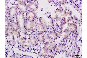 Formalin-fixed and paraffin embedded rat kidney tissue labeled with Anti-AGEs Polyclonal Antibody, Unconjugated (ABIN738516) at 1:200 followed by conjugation to the secondary antibody and DAB staining (AGE 抗体)
