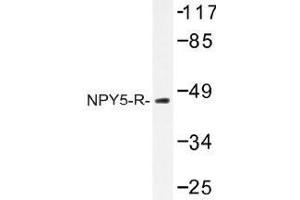 Image no. 1 for anti-Neuropeptide Y Receptor Y5 (NPY5R) antibody (ABIN317759) (NPY5R 抗体)