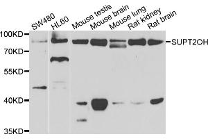 Western blot analysis of extracts of various cell lines, using SUPT20H antibody (ABIN5975125) at 1/1000 dilution. (FAM48A/P38IP 抗体)