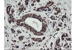 Immunohistochemical staining of paraffin-embedded Human breast tissue using anti-CHN1 mouse monoclonal antibody. (CHN1 抗体)