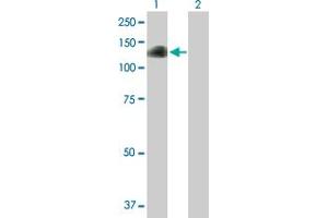 Western Blot analysis of DZIP1 expression in transfected 293T cell line by DZIP1 MaxPab polyclonal antibody. (DZIP1 抗体  (AA 1-867))