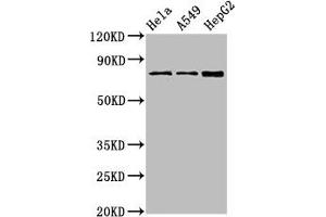 Western Blot Positive WB detected in: Hela whole cell lysate, A549 whole cell lysate, HepG2 whole cell lysate All lanes: TGM2 antibody at 4 μg/mL Secondary Goat polyclonal to rabbit IgG at 1/50000 dilution Predicted band size: 78, 62, 39 kDa Observed band size: 78 kDa (Transglutaminase 2 抗体  (AA 4-544))