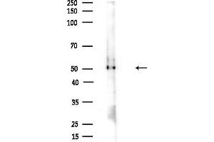 anti-3-Oxoacid CoA Transferase 1 (OXCT1) (Internal Region) antibody