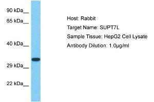 Host: Rabbit Target Name: SUPT7L Sample Type: HepG2 Whole Cell lysates Antibody Dilution: 1. (SUPT7L 抗体  (C-Term))