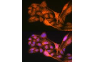 Immunofluorescence analysis of U-2 OS cells using Gli3 Rabbit mAb (ABIN7267385) at dilution of 1:100 (40x lens). (GLI3 抗体)