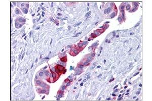 Human Pancreas, Duct: Formalin-Fixed, Paraffin-Embedded (FFPE) (Retinoblastoma Binding Protein 8 抗体)