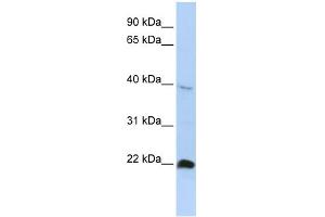 WB Suggested Anti-NKX3-2 Antibody Titration: 0. (NKX3-2 抗体  (Middle Region))