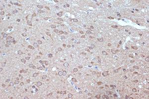 Immunohistochemistry of paraffin-embedded rat brain using B Rabbit mAb (ABIN7265849) at dilution of 1:100 (40x lens). (BAG2 抗体)