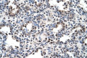 Image no. 1 for anti-Family with Sequence Similarity 134, Member B (FAM134B) (AA 160-209) antibody (ABIN205065) (FAM134B 抗体  (AA 160-209))
