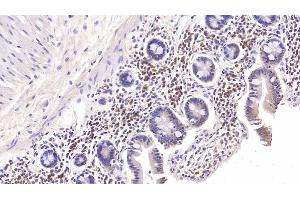Detection of IL6 in Rabbit Colon Tissue using Monoclonal Antibody to Interleukin 6 (IL6) (IL-6 抗体  (AA 27-241))