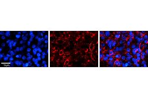 Immunohistochemistry (IHC) image for anti-Prostate Tumor Overexpressed 1 (PTOV1) (N-Term) antibody (ABIN2784251)
