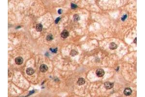 Detection of VEGF165 in Human Liver Tissue using Monoclonal Antibody to Vascular Endothelial Growth Factor 165 (VEGF165) (VEGF 165 (AA 28-191) 抗体)