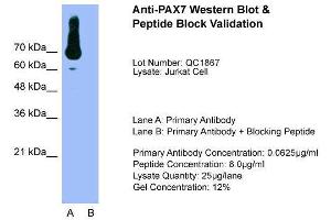 Western Blotting (WB) image for anti-Paired Box 7 (PAX7) (N-Term) antibody (ABIN2779615)