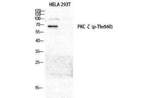 Western Blotting (WB) image for anti-Protein Kinase C, zeta (PRKCZ) (pThr560) antibody (ABIN3172963) (PKC zeta 抗体  (pThr560))