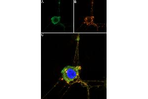 Dorsal root ganglia (DRG) cells were isolated from the lumbar and thoracic regions of 3-week-old Sprague-Dawley rats and cultured for 9 days in DMEM/F12 medium supplemented with 100 ng/mL Native mouse NGF 2.