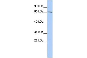 WB Suggested Anti-ZNF530 Antibody Titration:  0. (ZNF530 抗体  (N-Term))