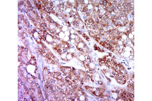 Paraformaldehyde-fixed, paraffin embedded human liver carcinoma; Antigen retrieval by boiling in sodium citrate buffer (pH6. (HRH4 抗体  (AA 285-390))