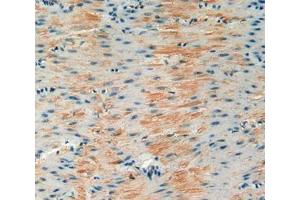 Used in DAB staining on fromalin fixed paraffin- embedded stomach tissue (IGFBP6 抗体  (AA 46-238))