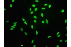 Immunofluorescence staining of Hela cells(treated by 15 mM sodium butyrate for 30 min) with ABIN7127269 at 1:68,counter-stained with DAPI. (Recombinant HIST1H3A 抗体  (H3K4ac))