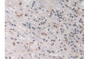 Detection of LCP1 in Human Appendix Tissue using Polyclonal Antibody to L-Plastin (LCP1) (LCP1 抗体  (AA 5-233))