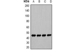 Western blot analysis of PGK1 expression in Hela (A), PC3 (B), ES2 (C), mouse stomach (D) whole cell lysates. (PGK1 抗体)