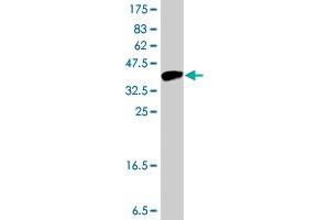 Western Blot detection against Immunogen (37 KDa) . (PRSS8 抗体  (AA 33-131))
