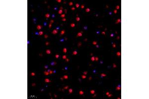 Immunofluorescence of paraffin embedded mouse brain using FUS (ABIN7075919) at dilution of 1:1000 (400x lens) (TLS/FUS 抗体)