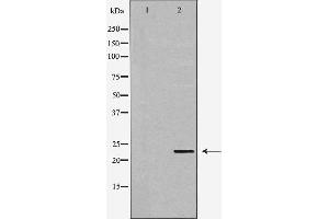 Western blot analysis of Hela whole cell lysates, using GSTP1 Antibody. (GSTP1 抗体  (N-Term))