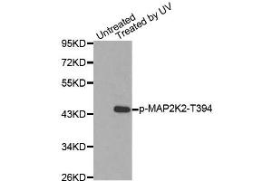 Western blot analysis of extracts from HepG2 cells using Phospho-MAP2K2-T394 antibody (ABIN2987359). (MEK2 抗体  (pThr394))