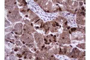Image no. 2 for anti-Antigen Identified By Monoclonal Antibody Ki-67 (MKI67) (AA 2924-3256) antibody (ABIN1491345) (Ki-67 抗体  (AA 2924-3256))