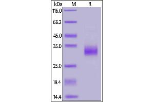 SDS-PAGE (SDS) image for Tumor Necrosis Factor (Ligand) Superfamily, Member 11 (TNFSF11) (AA 64-245) (Active) protein (His tag,AVI tag,Biotin) (ABIN6973285)