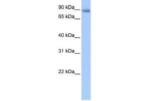 WB Suggested Anti-JAKMIP1 Antibody Titration:  0. (JAKMIP1 抗体  (Middle Region))