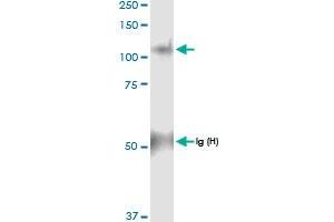 Immunoprecipitation of PYGL transfected lysate using anti-PYGL MaxPab rabbit polyclonal antibody and Protein A Magnetic Bead , and immunoblotted with PYGL MaxPab rabbit polyclonal antibody (D01) . (PYGL 抗体  (AA 1-847))