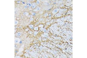 Immunohistochemistry of paraffin-embedded mouse spinal cord using E/SLC1 Rabbit mAb (ABIN7270394) at dilution of 1:100 (40x lens). (SLC1A3 抗体)