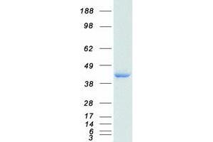 Western Blotting (WB) image for Cathepsin B (CTSB) (Transcript Variant 5) protein (Myc-DYKDDDDK Tag) (ABIN2713227)